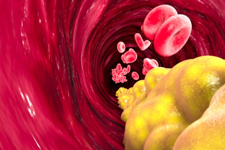 LDL cholesterol in blood stream