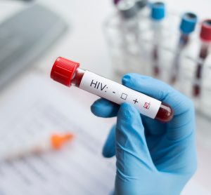 HIV blood test with positive box ticked