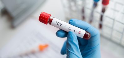 HIV blood test with positive box ticked