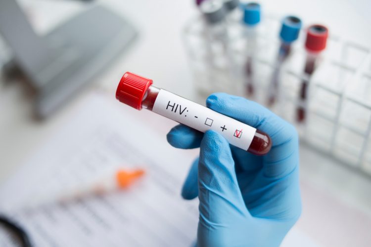 HIV blood test with positive box ticked