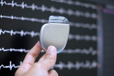 Implantable cardioverter defibrillator