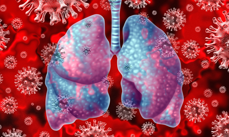 Lungs with coronavirus