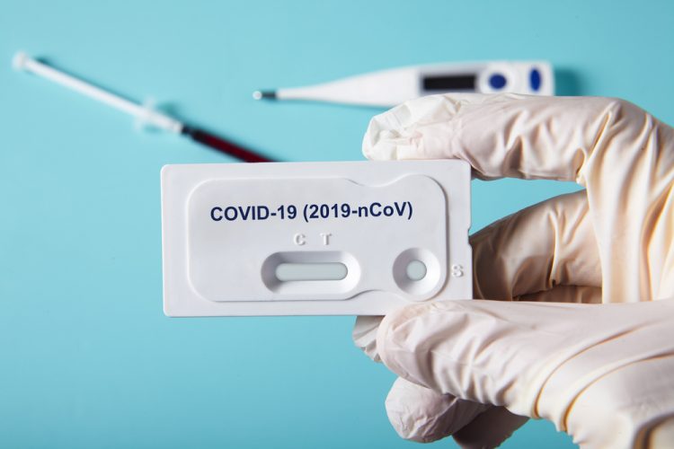 COVID-19 test