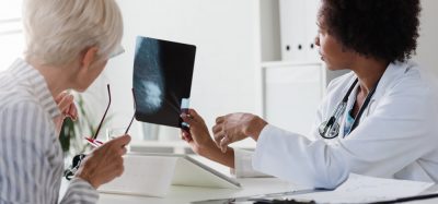 Doctor showing breast screening