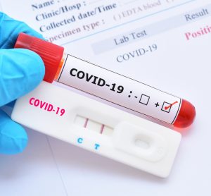COVID-19 diagnostic