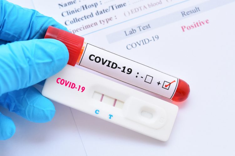 COVID-19 diagnostic