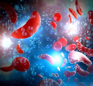 FDA approves first cell-based gene therapies for sickle cell disease