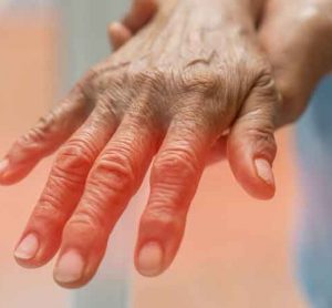 close up of a person's hand - concept of peripheral nervous system disorders such as polyneuropathy