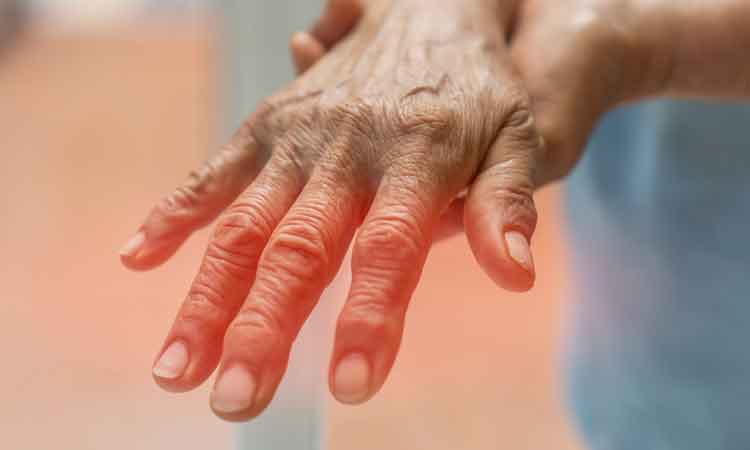 close up of a person's hand - concept of peripheral nervous system disorders such as polyneuropathy