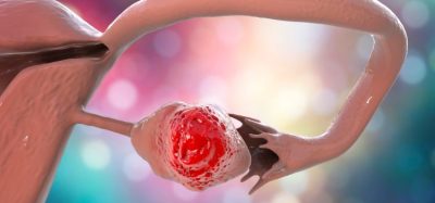 EC approves rucaparib as first-line ovarian cancer treatment