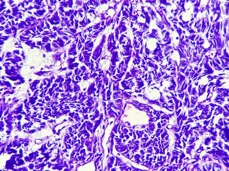 Microscopic view of esophagus