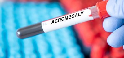 European Commission acromegaly