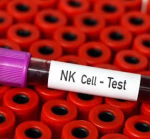 CAR NK cell therapy
