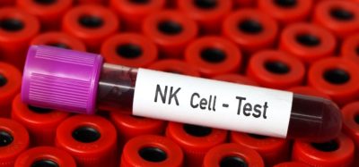 CAR NK cell therapy