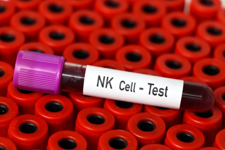 CAR NK cell therapy