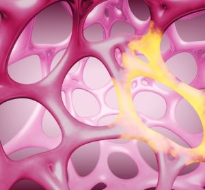 Eli Lilly Ventyx Biosciences