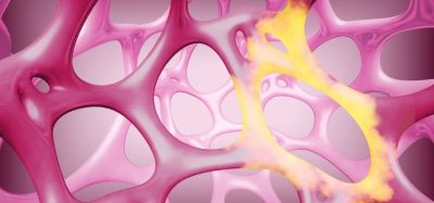 Eli Lilly Ventyx Biosciences