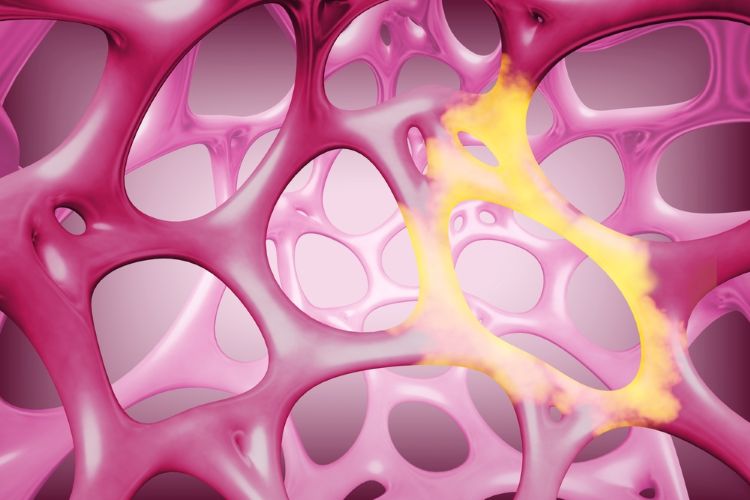 Eli Lilly Ventyx Biosciences