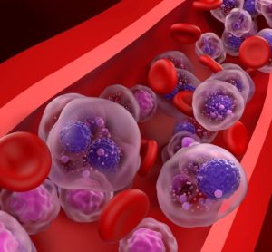 multiple myeloma cell therapy biologics