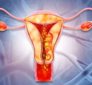 endometrial cancer antibody