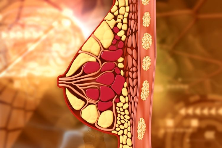 breast cancer ribociclib