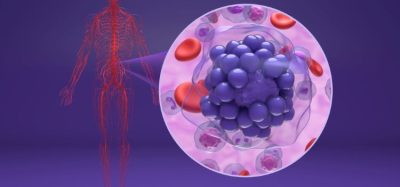CAR T therapy lymphoma