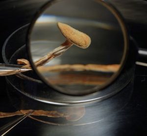psilocybin treatment-resistant depression (TRD) compass pathways