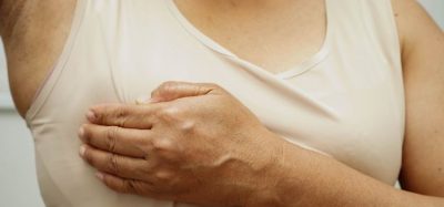 breast cancer capivasertib with fulvestrant National Institute For Health and Care Excellence (NICE)