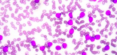 Stem cell transplant antibody