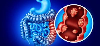 pfizer Braftovi colorectal cancer