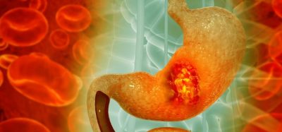 CHMP Imfinzi chemotherapy