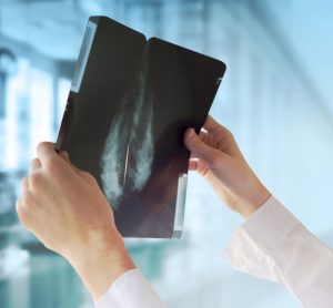 Doctor with mammography
