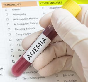 Anemia blood test