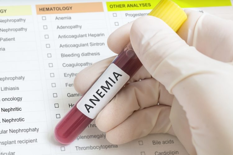 Anemia blood test