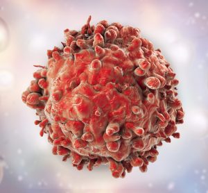 leukaemia