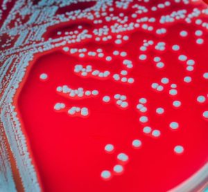 microbial identification and bacterial contamination