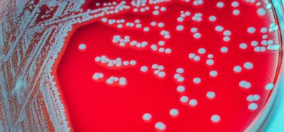 microbial identification and bacterial contamination