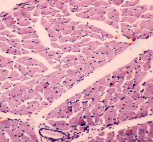 NMD Pharma ignaseclant