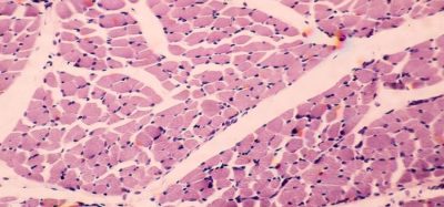 NMD Pharma ignaseclant