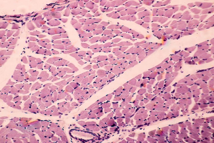 NMD Pharma ignaseclant