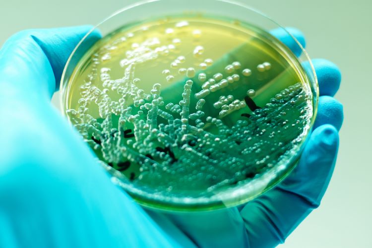 pseudomonas aeruginosa (P. aeruginosa) detection