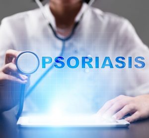 plaque psoriasis