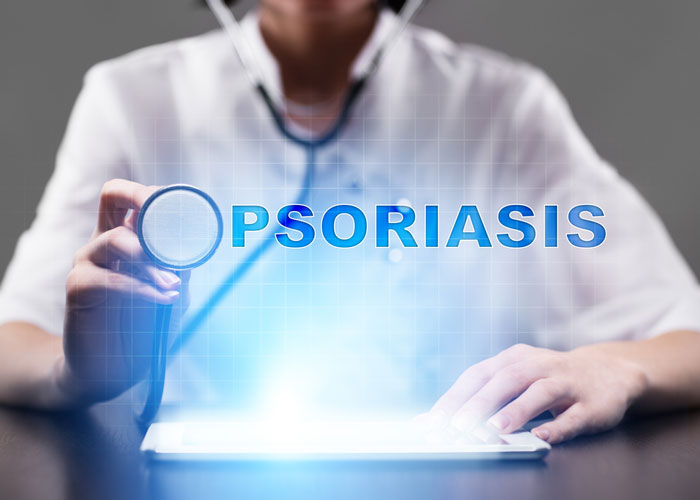 plaque psoriasis