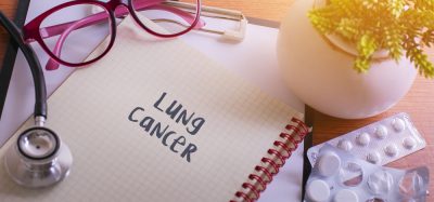 Notepad with "lung cancer" written on