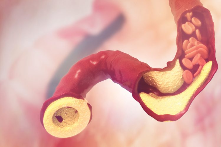 Nilendo as hypercholesterolaemia treatment