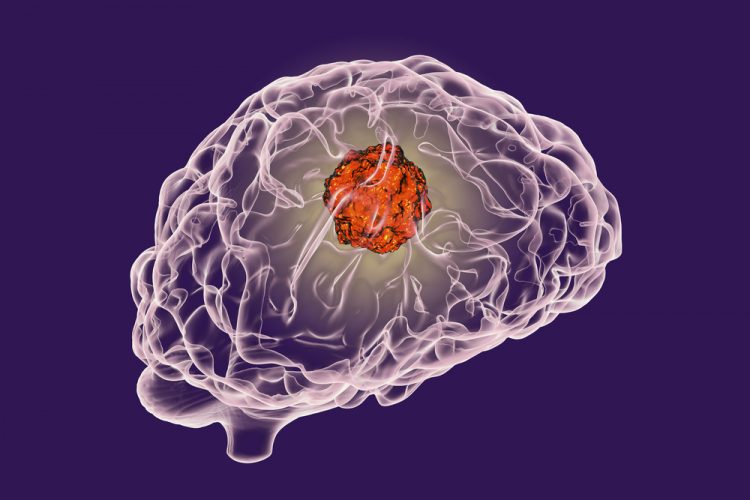 brain-tumour