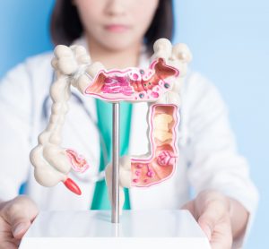 Doctor holding colon model