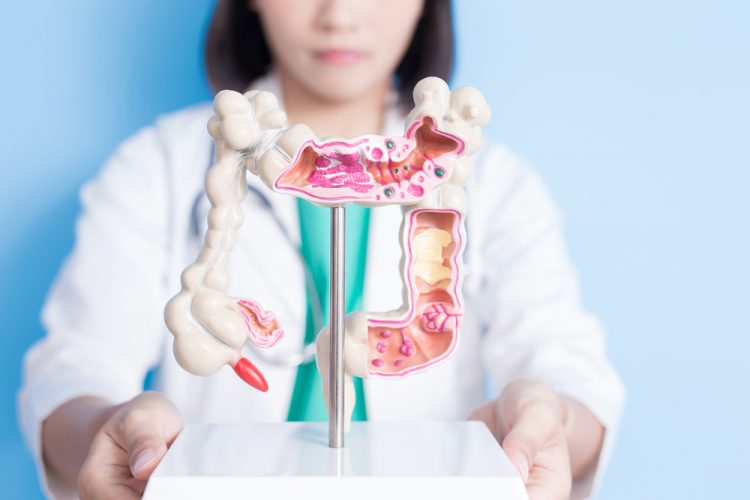 Doctor holding colon model