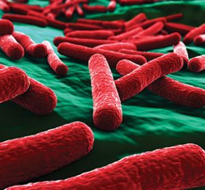 Protein Expression