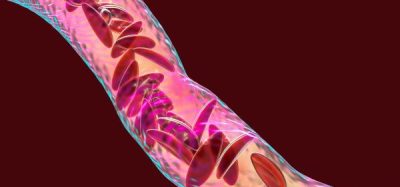 EC revokes authorisation for Novartis’ crizanlizumab